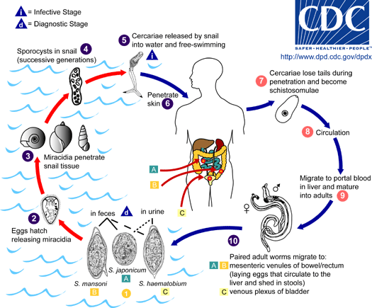 schistosomiasis symptomen)